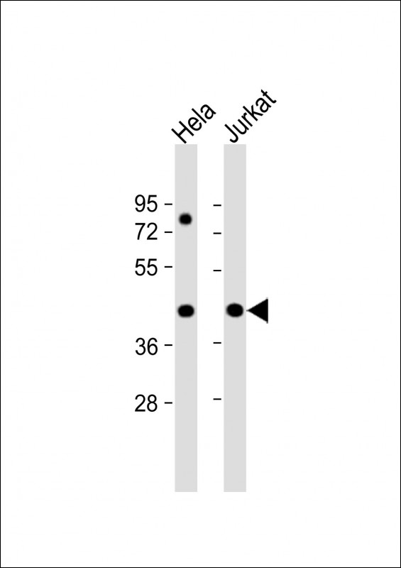 WB - PR38A Antibody  (C-term) AP9930b